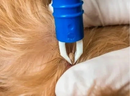 tick tweezers
