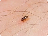 closeup of flea on human skin