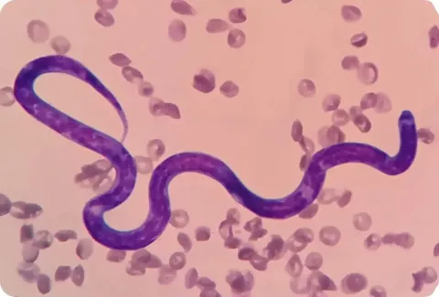 heartworm disease