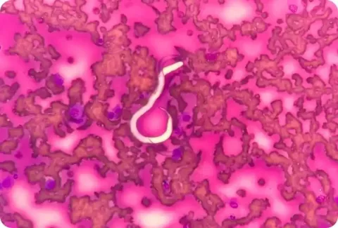 heartworm
