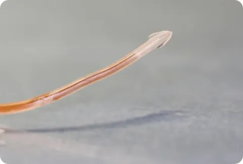 roundworm