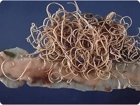 Roundworm_1