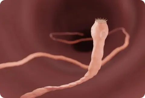 Tapeworm