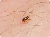 closeup of flea on human skin
